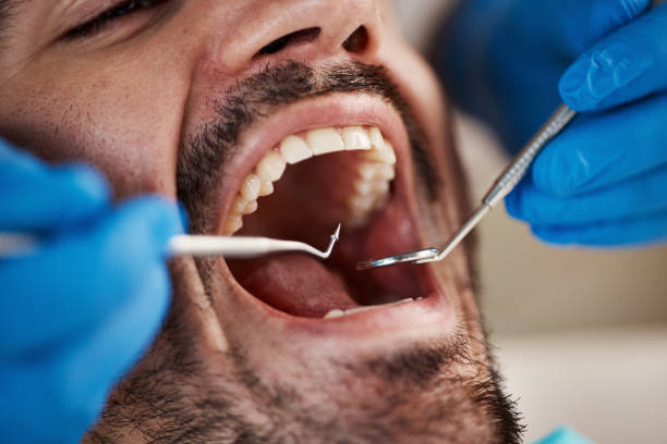 Best Emergency TMJ Treatment in Red Corral, CA